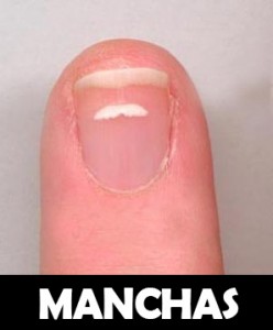 manchas