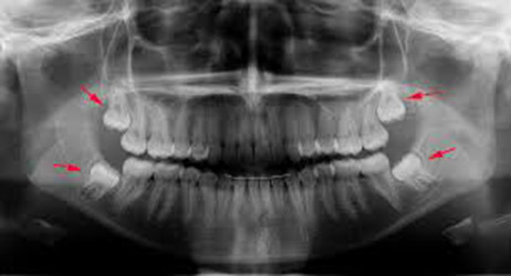 4_partes_corpo_desnecessarias_1